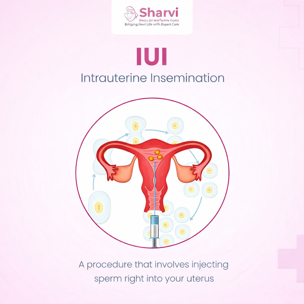 iui treatment sharvi diagnostic and fertility centre