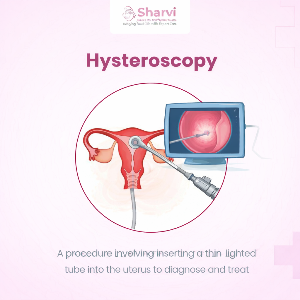 hysteroscopy treatment sharvi diagnostic and fertility centre