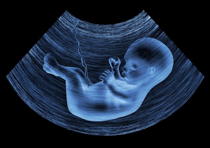 NT-scan Ultrasound image of baby in mother's womb